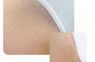 laserville бікіні