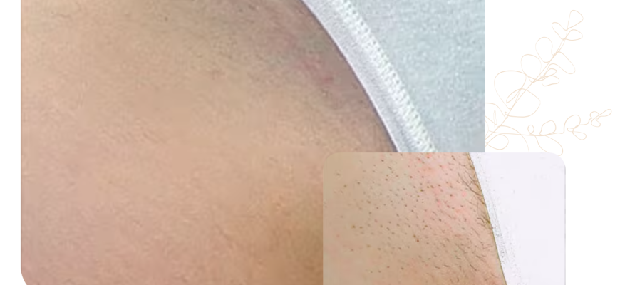 laserville бікіні